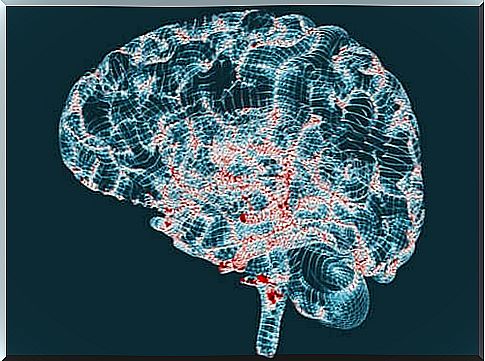 Huntington's disease: features and symptoms